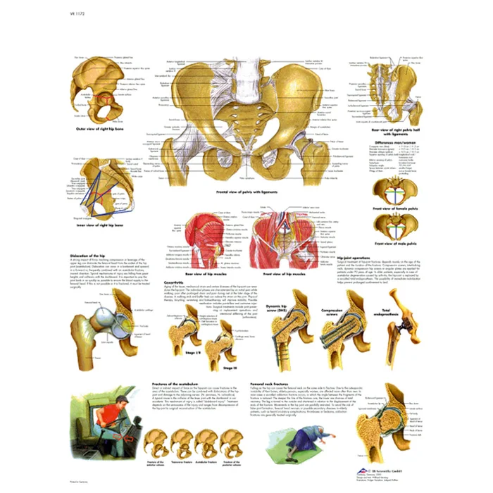 Becken und Hüfte – Anatomie und Pathologie – Poster | W-21855UB