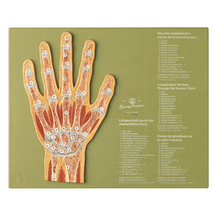 Gelenkschnittdarstellung Hand | W-2041